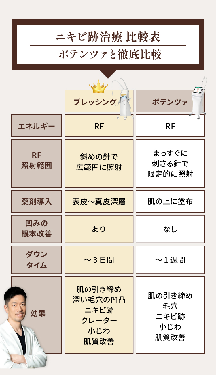 ニキビ跡治療比較表 ポテンツァと徹底比較